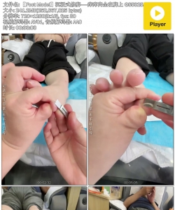 ��Foot Model������ʽ�޽š���������ȫ�ڽ���
